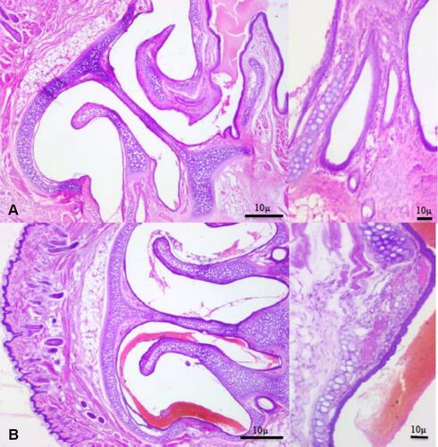 Figure 13 Photomicrographs showing nasal turbinates and nasal mucosa (H&E staining), (A) control, (B) NOHAL solution.