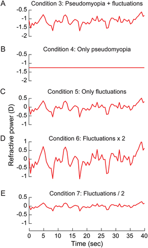 Figure 2. The mean pattern of refractive fluctuations plotted as a function of time for patients with SNR-A that participated in the study of Bharadwaj et al.Citation2 These fluctuations were induced before the right eye of healthy subjects in this study as is (panel A), with only pseudomyopic refraction (panel B), with only the temporal fluctuations in refractive power about baseline emmetropia (panel C), with only temporal fluctuations in refractive power but with double its amplitude (panel D) and half its amplitude (panel E).