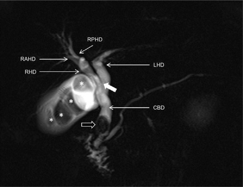 Figure 7 MRCP.