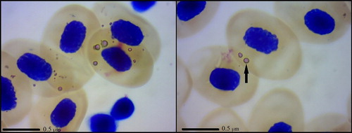 Figure 1. Photomicrographs of Giemsa-stained rickettsial inclusions found in N. kaiseri.
