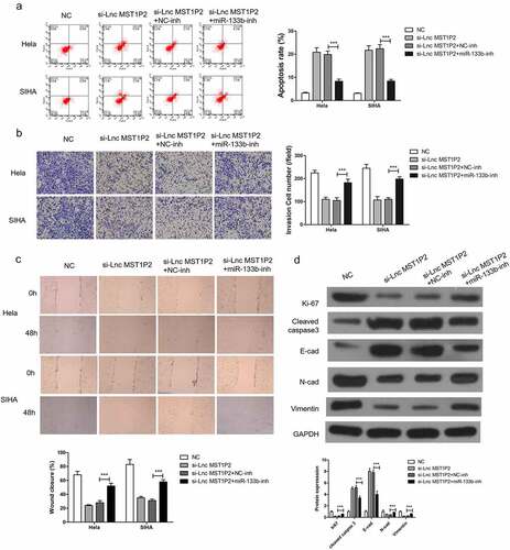 Figure 4. miR-133b inhibition reverses anti-tumor roles of si-Lnc MST1P2 in Hela and SIHA cells. Cells were co-transfection in si-Lnc MST1P2 and miR-133b inhibitor. (a) detection of cell apoptosis. (b) detection of cell invasion. (c) detection of cell migration. (d) Western blot analysis of protein level. ***P < 0.001