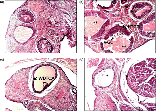 Figure 7. (a–d) Microscopic study of lateral section of rat ovary. Histological sections of ovary were stained with hematoxylin and eosin. (a) Representative photograph of control rat ovary (H&E, 10×) (b) Representative photograph of letrozole induced PCOS rats (** - indicates large cystic dilated follicles, HTC ? indicates hyperplastic thecal cells, GC ? indicates attenuated granulosa cells) (H&E, 100×) (c) Representative photograph of soy isoflavone 50 mg/kg treated PCOS rats (WDTC ? indicates well-defined thecal cell layer) (H&E, 10×) (d) Representative photograph of soy isoflavone 100 mg/kg treated PCOS rats (* - indicates normal follicle) (H&E, 10×).