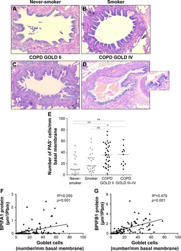 Figure 7 Goblet cell quantification and correlation with BPIFA1 and BPIFB1 protein expression in airway epithelium.