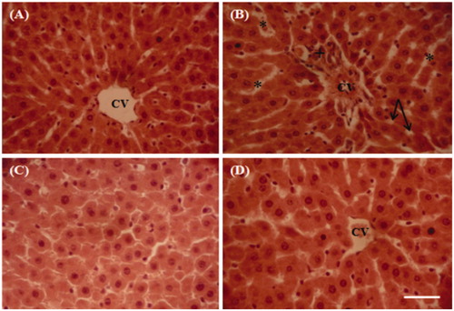 Figure 6. Representative photographs from the liver showing the protective effect of cactus cladode extract on lithium carbonate induced hepatic injury in rats. (A) Controls, (B) rats treated with lithium carbonate, (C) rats treated with cactus cladode extract and (D) rats treated with the combination of cactus cladode extract and lithium carbonate. Liver sections were stained using the haematoxylin-eosin method. Original magnifications: ×400; CV: central vein in the liver + congested central veins; *sinusoidal dilatation; vacuolization: inflammatory cell infiltration.