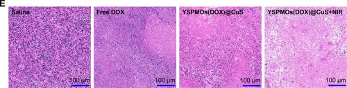 Figure 6 In vivo antitumor activity.Notes: (A) Tumor growth curves of mice after various treatments. (B) Photographs of tumor blocks collected from different treatment groups of mice on day 18. (C) Body weight changes of mice in different treatment groups within 18 days. (D) The tumor weights at the end of therapy on day 18. (E) Representative H&E sections of tumors after different treatments. *p<0.05, **p<0.01.Abbreviations: H&E, hematoxylin and eosin; YSPMOs, yolk–shell-structured periodic mesoporous organosilica nanoparticles.
