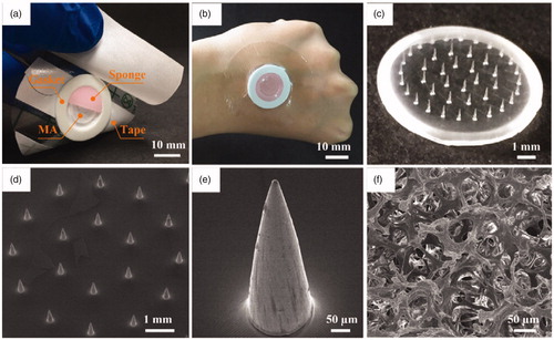 Figure 2. (a) Photo of TMAP and its components, (b) image of TMAP taped on the back of a human hand, (c) photo of solid MA, (d) SEM image of solid MA, (e) SEM image of one of the microneedles, and (f) SEM image of medical sponge.
