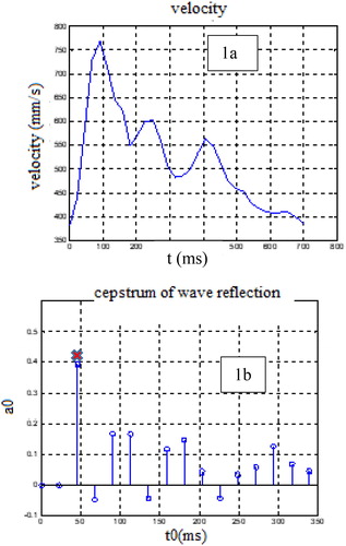 Figure 1. Blood velocity signal and its Cepstral analysis: (a). Blood velocity signal. (b). Cepstral analysis of the blood velocity, the red cross indicates the selected peak corresponding to the delay time.