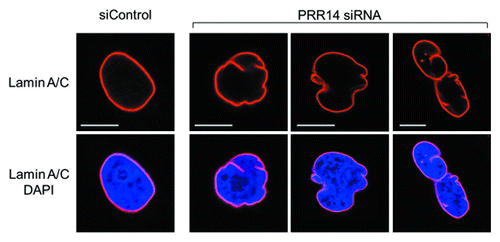 Figure 3. Confocal imaging showing nuclear lamina defects after PRR14 knockdown. Cells were transfected with the indicated siRNAs and monitored by confocal imaging 72h post-transfection. Scale bars, 10 μm.