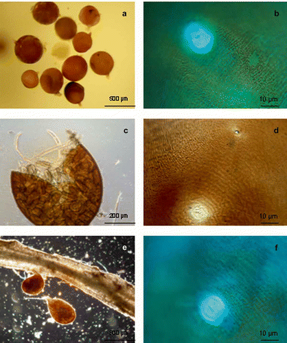 Fig. 2. Photomicrographs of the cysts of G. rostochiensis associated with potato in Quebec, Canada: a, and e, spherical shaped cysts; c, crushed cyst to reveal eggs and juveniles; b, d, and f, perineal region of cysts.