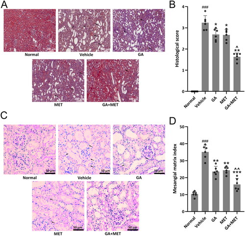 Figure 4. Effects of metformin combined with gallic acid treatment on histopathological change of the kidney at the end of 4 weeks treatment. (A) Representative HE staining among different groups and the quantification of histological score (B). The data were gotten from six mice in each group and the data point indicates the average of single mouse from eight random fields. (C) Representative Periodic Acid Schiff (PAS) staining among different groups and the quantification of mesangial matrix index (D). The data were gotten from six mice in each group and the data point indicates the average of single mouse from 10 random fields. Data are presented as mean ± SD. ###p < 0.001 compared to normal. *p < 0.05, **p < 0.01, ***p < 0.001 compared to vehicle. ^p < 0.05, ^^p < 0.01 compared to MET group.