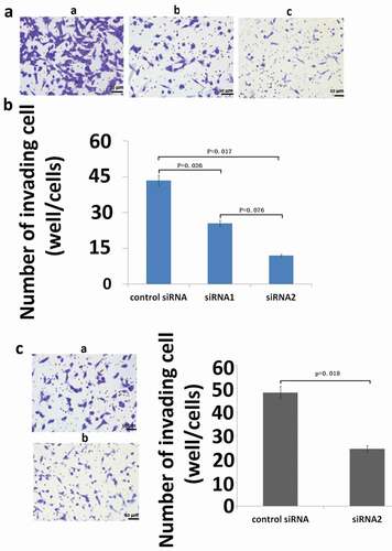 Figure 4. Effect of inhibition of S100A9 mRNA on the invasive potential of MG63 (A and B) and U2OS (C) cells. For invasion assays, cells transfected with siRNA were seeded in a cell migration chamber with the inner well coated with Matrigel (40 ug for MG63, 20ug for U2OS) and incubated for 48 h (MG63) or 72 h (U2OS). The number of cells invading through the Matrigel-coated membrane was then counted. (a) Representative photomicrographs of MG63 cells treated with control siRNA (a), siRNA1 against S100A9 (b), and siRNA2 against S100A9 (c). Original magnification, ×100. (b) There were significant differences in the number of invading cells between the groups (P = 0.026, control siRNA versus siRNA1 against S100A9; P = 0.017, control siRNA versus siRNA2). (c) Representative photomicrographs of U2OS cells transfected with control siRNA (a) or siRNA2 against S100A9 (b). Original magnification, ×100.There was a significant difference between the two groups (P = 0.002).