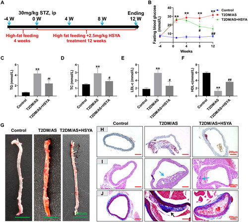 Figure 1. HSYA reduces lipid accumulation in the T2DM + AS model mice (A) Operation timeline of the animal experiments; (B) ApoE-/- mice were fed a high-fat diet before induction (week-4) 4 days after the injection of 30 mg/kg STZ for 3 consecutive days (week 1). the high-fat diet induction continued until the end of the experiment (week 12). Mouse FBG test results; (C-F) at the end of the experiment, the TG, TC, LDL-c, and HDL-c levels in the serum of the mice were detected (n = 8); the whole aorta was stained with G oil red O; (H) oil red O-stained frozen sections of the aortic tissue; (I) the HE staining results of the mouse aortic tissue, with blue arrows indicating lipid plaques; (J) Masson staining results of the mouse aortic tissue, plaque collagen deposition is marked with black arrows. Compared with the control group, *p < 0.05, **p < 0.01; compared with the T2DM/AS group, #p < 0.05, ##p < 0.01.