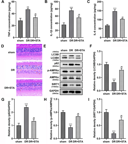 Figure 6 STA relieved the DR progression in vivo. STA treatment significantly decreased the (A) TNF-α, (B) IL-1β and (C) IL-6 levels in the retinal tissue of DR rats. (D) HE staining results showed that STA treatment relieved the injury of the retinal tissue in DR rats. (E–I) STA treatment increased the protein levels of LC3BII, p-AMPKα and SIRT1, and decreased the p63 levels in the retinal tissue of DR rats. **p<0.01, ***p<0.001. ##p<0.01.