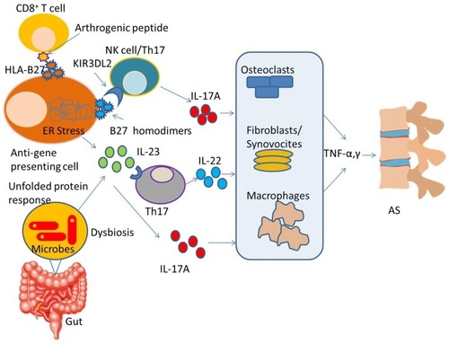 Figure 3 Schematic diagram of the proposed role of genetic and environmental factors in the pathogenesis of AS. As shown in the figure, auto-reactive CD8+ T cells may recognize arthritogenic peptides displayed by HLA-B27 on the anti-gene presenting cell surface and cause misfolding of HLA-B27 which leads to stress in the ER and consequently causes overproduction of IL-23. On the other hand, abnormal cell-surface expression of HLA-B27 leads to interactions with the innate immune receptor KIR3DL2 (killer immunoglobulin-like receptor) on CD4+T cells and promotes type 17 immune responses. Environmental factors (like microbes present in gut) activate HLA-B27, which cause intestinal dysbiosis, resulting in overexpression of the IL-17A. IL-23 axis with the activation of Th17 and other innate immune cells. This leads to the production of IL-17A, IL-22, TNF-α, TNF-γ and other cytokines which directly affect organs.Abbreviations: ER, endoplasmic reticulum; AS, ankylosing spondylitis; HLA, human leukocyte antigen; TNF, tumor necrosis factor.
