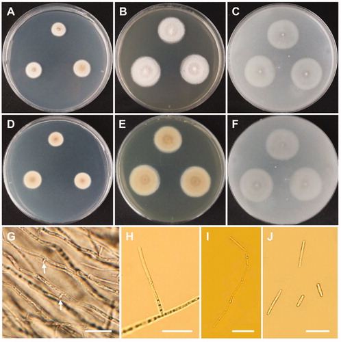 Figure 10. Morphology of Mycoarthris corallina CNUFC MSW242-6. (A,D) Colonies on potato dextrose agar. (B,E) Colonies on malt extract agar. (C,F) Colonies on oatmeal agar. (A–C) obverse view, (D–F) reverse view. (G) Anastomosing hyphae (white arrows). (H) Conidiophore. (I) Chain of arthroconidia. (J) Conidia. Scale bars: G-J = 20 µm.
