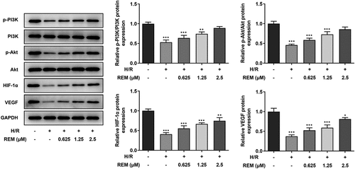 Figure 4. REM preconditioning regulates the PI3K/Akt/HIF-1α signaling pathway in HCMECs The expression of relevant proteins to the PI3K/Akt/HIF-1α signaling pathway in HCMECs pre-treated with different concentrations of REM following H/R, detected by western blot. *P < 0.05, ** P < 0.01, ***P < 0.001 vs Control