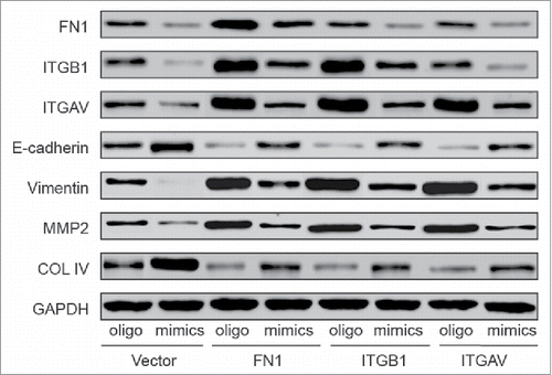 Figure 7. The protein levels of transfected cells were detected with western blot. Upregulation of FN1, ITGB1 or ITGAV improved the expression of Vimentin, MMP2, downregulated the level of E-cadherin and COL IV and also facilitated the EMT process. Simultaneous overexpression reduced the FN1, ITGB1, ITGAV levels and abrogated the promoting effect of FN1, ITGB1 or ITGAV on EMT process.