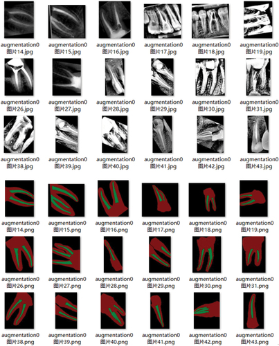 Figure 4. Root canal data set after data augmentation.