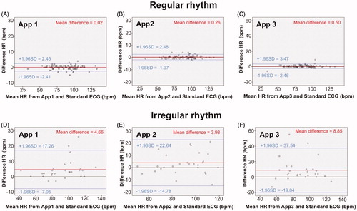 Figure 2. Bland-Altman plots of limits of agreement in heart rate (HR) measurement by tested applications (App1, App2, and App3) compared to standard electrocardiogram (ECG). In patients with regular heart rate (A–C), the accuracy of all applications was excellent. However, the accuracy was less when measured in the patients with irregular and higher heart rates (D–F). The 95% level of agreement is equal to 1.96 standard deviation of the difference.