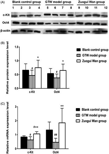 Figure 3. (A) Western blotting analysis of c-Kit and Oct4 protein expression in rat testicular tissue in various groups; (B) proportions of c-Kit and Oct4 protein expression grey values in the testicular tissue of rats in various groups; (C) c-Kit and Oct4 mRNA expressions in rat testicular tissue. ##p < 0.01, #p < 0.05 compared to Blank control group, *p < 0.05, **p < 0.01 compared to GTW model group.