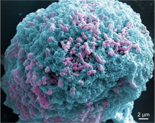 Figure 7 SEM image of an Streptococcus mutans biofilm treated with Ag-MSNs for 24 hours.Note: The image is presented with pseudo-color to identify the bacteria (pink) and nanoparticle (cyan).Abbreviations: Ag-MSNs, silver-decorated mesoporous silica nanoparticles; SEM, scanning electron microscopy.