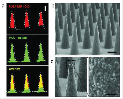 Figure 7. (a) Confocal microscopy images of PLGA-PAA composite microneedles fabricated to encapsulate DiD-loaded PLGA microparticles (MP) (right, scale bar 200 μm). SEM images of (b) resulting microparticle-encapsulating microneedle array (scale bar 200 μm) and (c) high magnification image of the composite needle interior of a fractured microneedle (scale bar 10 μm). Reprinted with permission from Reference 64.