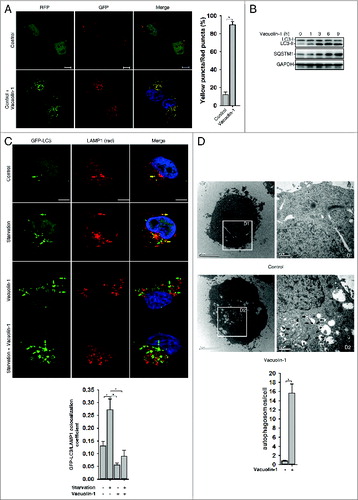 Figure 1. Vacuolin-1 inhibited the fusion between autophagosomes and lysosomes in HeLa cells. (A) Vacuolin-1 induced the accumulation of yellow LC3-II puncta in tfLC3B-expressing HeLa cells. Scale bar: 20 μM. Quantification of LC3 yellow puncta/red puncta (%) is expressed as mean ± S.E., n = ∼80 cells of 3 independent experiments. (B) Vacuolin-1 (1 μM) induced the accumulation of both LC3B-II and SQSTM1 in HeLa cells. (C) Vacuolin-1 (1 μM) markedly induced GFP-LC3B-II puncta in HeLa cells, which were not colocalized with RFP-LAMP1. Scale bar: 20 μM. The GFP-LC3B and LAMP1 colocalization coefficiency is expressed as mean ± S.E., n = ∼80 to 100 cells of 4 independent experiments. (D) Vacuolin-1 (1 μM) induced the accumulation of autophagic vacuoles as shown in the electron micrographs and highlighted in areas D1 and D2. Quantification of autophagosomes per cell are expressed as mean ± S.E., n = ∼20 to 40 cells. The *symbols indicate the results of the Student t test analysis, P < 0.05.