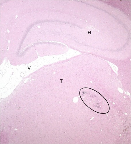 Figure 5 Photomicrograph of a transverse rat brain section (4 μm) from the VPL nucleus of the thalamus.