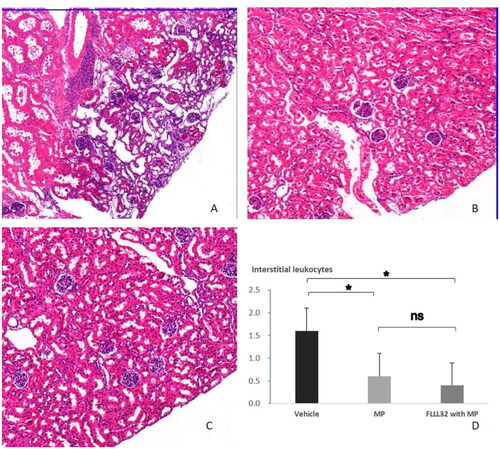 Figure 5. Representative images (H&E staining, original magnification, ×50) and renal interstitial leukocytes. A, AKI mice in vehicle group showed remarkable interstitial infiltration of inflammatory cells; B, noAKI mice in MP group with less interstitial infiltration of inflammatory cells; C, noAKI mice in FLLL32 with MP group with less interstitial infiltration of inflammatory cells. D, comparison of interstitial inflammation.