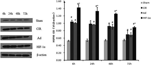 Figure 7. Relative quantification of HSP90 protein expression using western blot analysis at different reperfusion time points. Western blot analysis was used to detect the protein expression of HSP90. Data were obtained by densitometry and normalized using β-actin as a loading control. Data are presented as mean ± SD. *p < 0.01 vs. CIR and Ad groups, #p < 0.01 vs. normal and sham groups.