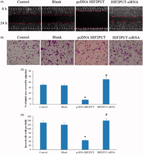 Figure 4. LncRNA HIF2PUT inhibited osteosarcoma stem cell migration and invasion. (A) Wound-healing assay suggested lncRNA HIF2PUT overexpression inhibited osteosarcoma stem cell migration, lncRNA HIF2PUT knockdown promoted osteosarcoma stem cell migration. (B) Transwell assay suggested lncRNA HIF2PUT overexpression inhibited osteosarcoma stem cell invasion, lncRNA HIF2PUT knockdown promoted osteosarcoma stem cell invasion. (C) and (D) Data represented mean ± SD from three independent experiments (*p < .05, compared with the control and blank groups; #p < .05, compared with the pcDNA HIF2PUT group).