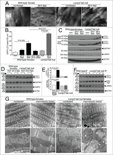 Figure 2 (See previous page). Intermittent fasting is associated with impaired autophagic flux in Lamp2 heterozygous null mice. (A) Representative gray-scale images (at 630X magnification) of female Lamp2 heterozygous null and littermate wild-type female mice bearing the GFP-LC3 transgene, after 48 h of fasting or in a fed (nonfasted) state. (B) Quantification of cardiomyocyte GFP-LC3 in Lamp2 heterozygous null mice or littermate control females after fasting and/or refeeding for the indicated duration; n = 3 or 4/group. P values depicted are by post-hoc test after one-way ANOVA. (C) Immunoblots depicting LC3 processing and SQSTM1 accumulation in Lamp2 heterozygous null mice with progressively longer periods of fasting, as compared with nonfasted littermate wild-type female controls. ACTA1 was employed as loading control. (D and E) Representative immunoblots (D) and quantification of ratio of LC3-II (E, top) and SQSTM1 (E, bottom) in cardiac extracts from Lamp2 heterozygous null mice and female littermate wild-type controls subjected to 24 h fasting or provide ad libitum access to diet and treated for CQ or diluent (for 4 h prior to sacrifice). N = 3 /group. P values are by post-hoc test after one-way ANOVA. (F) Representative immunoblots depicting LC3 and SQSTM1 in Lamp2 heterozygous null mice and female littermate wild-type mice subjected to intermittent fasting for 6 wk, and treated for CQ or diluent (for 4 h prior to sacrifice) on a fed day. (G) Representative transmission electron microscopy images of cardiac tissues from Lamp2 heterozygous null mice and female littermate wild-type mice subjected to intermittent fasting, or provided ad libitum access to food for 6 wk, on a fed day. N = 3 /group. Arrows indicate mitochondria with loss of cristal architecture, and arrowheads point to autophagic structures.