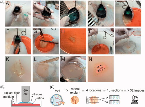 Figure 2. (A) Step-by-step overview of the dissection protocol to culture a bovine vitreoretinal explant. (B) set-up for ‘direct imaging’ of the vitreoretinal explant. (C) Workflow applied for cryosectioning of the retina and cryosection imaging.