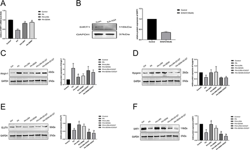 Figure 5 Liraglutide and semaglutide mitigated PA induced muscle atrophy and insulin resistance via the SIRT1 pathway. (A) The mRNA level of SIRT1 was measured by qRT-PCR. (B) The effect of 100 µM EX-527 on inhibiting SIRT-1 protein expression was determined by Western blotting. (C) The protein expression of Atrogin-1 was assessed by Western blotting. (D) The protein expression of Myogenin was assessed by Western blotting. (E)The protein expression of GLUT4 was assessed by Western blotting. (F) The protein expression of SIRT1 was assessed by Western blotting. *P < 0.05 compared with the control group, #P < 0.05 compared with the PA group, &P < 0.05 compared with the PA+LIRA or PA+SEMA group.