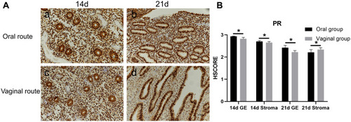 Figure 3 Photomicrographs (×200) showing immunohistochemical localization of PR in endometrium from oral and vaginal women. Both glandular epithelial and stromal compartments demonstrated more intense nuclear immunoreactivity for PR on day 14 (a, c, (A)) than on day 21 (b, d, (A)) and more intense in the oral (a, b, (A)) versus vaginal group (c, d, (A)), but there were no significant differences(*P>0.05, (B)). P values are for Mann–Whitney U-test.