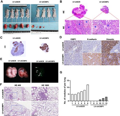 Figure 4 Knockdown of CtBP1 reverses hypoxia-induced sarcomatoid transformation in HepG2 xenografts. (A) Knockdown of CtBP1 inhibited the tumor growth of HepG2 xenografts. (B) H & E staining shows that the control xenografts present more necrotic areas (N), less epithelial areas (E) and emerging sarcomatoid areas (S), while CtBP1 knockdown xenografts show less necrotic areas and no sarcomatoid areas. (C) Immunostained pancytokeratin (CK) shows that most of the control xenografts lost the epithelioid phenotype, while the CtBP1 knockdown xenografts maintained the epithelial marker CK except for the fibrous septa. (D) In CtBP1-silenced xenografts, the expression of the epithelial marker E-cadherin was upregulated and the expression of the mesenchymal marker vimentin was downregulated compared with those of the control group. (E) In vivo metastasis assays show that CtBP1 knockdown subcapsular xenografts in the liver present fewer secondary lung tumorlets. H & E staining (F) and numbers (G) of secondary lung tumorlets also suggested a decreased metastatic potential with CtBP1 knockdown.
