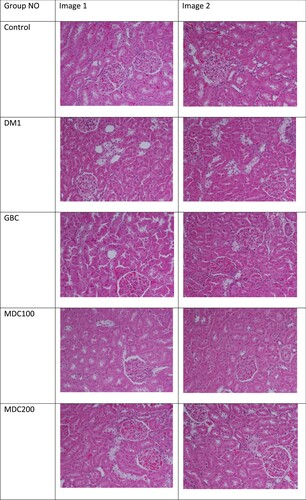 Figure 8. Effects of the extract of D. corderoyi on kidney histology of STS-induced diabetic rats.