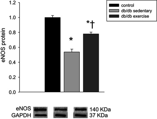 Figure 1 The effects of diabetes and exercise training on cardiac eNOS protein expression. Values are reported as mean ± SEM for 4–6 mice per group. *P<0.05, compared to lean control mice. †P<0.05 compared to db/db sedentary mice. Abbreviations: eNOS, endothelial nitric oxide synthane; GAPDH, glyceraldehyde-3- phosphate dehydrogenase.