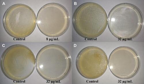 Figure 7 The MBC (μg/mL) test results of the control group and the different concentrations of AgNPs group.