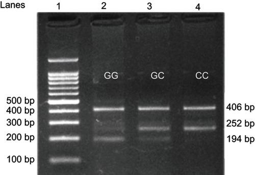 Figure 3 Detection of OGG1 rs1052133 C/G (Ser326Cys) single nucleotide polymorphism using the confronting two-pairprimer method (PCR-CTPP).