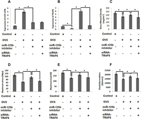 Figure 6 miR-125b-TRAF6 pathway regulates the progression of osteoporosis in OVX rats. (A) miR-125b levels were evaluated by qRT-PCR analysis. (B) mRNA levels of TRAF6 by qRT-PCR analysis. (C) Results of bone mineral density of isolated femurs. (D) Maximum bending stress of femur bones. (E) The maximum load bearing capacity of femur bones. (F) Results of elasticity modulus of femur bones. The results are mean ± SD. *P<0.05 compared with adjacent groups.