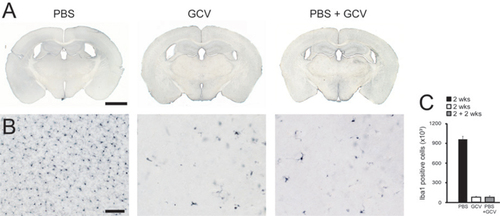 Figure 2. Experimental evaluation of the Y-con device.Y-con based pump reservoir exchange (first PBS, then GCV) and direct application of GCV lead to similar Iba1+ microglia ablation in the neocortex of TK mice. Three month old male TK mice received two weeks i.c.v. treatment of PBS, GCV, or PBS followed by two weeks GCV application (PBS + GCV) via pump exchange. (A) Direct i.c.v. infusion (left and middle panel) and pump reservoir replacement (right panel) using the Y-con, did not result in alterations of the lateral ventricle volume and revealed no tissue irritation. Calibration bar 2000 µm. (B) Iba1 immunohistochemistry in the neocortex of PBS-treated TK mice indicates a normal number of microglia cells (left panel), while direct application of GCV and treatment with PBS prior to GCV (PBS + GCV) via pump reservoir replacement resulted in almost complete microglia ablation (middle and right panel). Calibration bar: 100 µm. (C) Quantitative stereological analysis of Iba1+ cell number in the neocortex reveals a >90% ablation of microglia in TK mice after 2 weeks GCV treatment in comparison to the PBS treated control group (bars indicate the mean ± SEM; n = 3 mice/group). ANOVA indicates a significant difference between the three treatment groups (F(2,8) = 406.48; ***P < 0.001). Tukey HSD post-hoc analysis displays significant differences between the PBS and GCV treated TK mice.