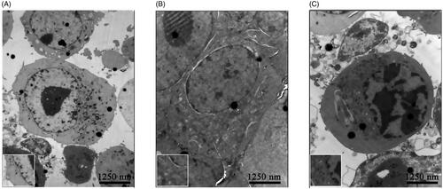 Figure 2. Effect of osthole on the ultrastructure of KA activated BV-2 cells. (A) Ultrastructure of BV-2 cells without any treatment; (B) ultrastructure of BV-2 cells with the treatment of KA for 2 h; (C) ultrastructure of BV-2 cells with the treatment of 140 μM osthole for 24 h before activated with KA for 2 h. Magnification: ×8000 times. Boxed areas shows the complete membrane of BV-2 cells in the control group, the swelled mitochondria in the KA-group and the marginated and contracted chromatin of BV-2 cells in the osthole group. Scale bars, 1250 nm.