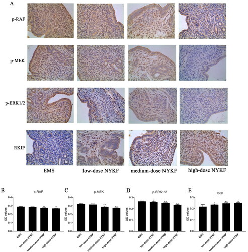 Figure 3. Effects of NYKF on protein expression in ectopic endometrium by IHC. A: The expression of p-RAF, p-MEK, p-ERK1/2, and RKIP in ectopic endometrium (×400). OD values were calculated for p-RAF (B), p-MEK (C), p-ERK1/2 (D), and RKIP (E). Data are shown as means ± SD (n = 6), and data between multiple groups were compared by one-way ANOVA. **p < .01 compared with EMS group.