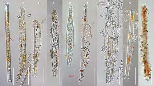 Figure 1. DIC light micrographs of Miracula einbuarlaekurica at different lifecycle stages in the freshwater pennate diatoms Ulnaria acus and Synedra ulna. (a) Early infection, with developing naked endobiotic holocarpic thalli, with remnants of a single encysted spore attached at the central area of the frustule (red arrow); (b) elongating unbranched thallus in an intermediate stage of development, causing gradual degradation of the host chloroplast into Orange-golden brown to chestnut-coloured residues; (c–f) late developmental stages, in diatoms containing a single (c) and multiple (d) thalli, with swellings forcing apart the host valves (c) or causing hyperthrophy (d); (e) fully formed mass of primary aplanospores within the sporangium (red arrow); (g, h) clusters of immotile primary spores at the orifice of the discharge tubes (h, red arrows); (i) zinc iodine stained empty thallus of M. einbuarlaekurica with a Spreizapparat at the base of each discharge tube (red arrows).