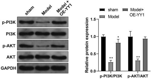 Figure 7. YY1 activates the PI3K/AKT pathway. Expression of PI3K/AKT pathway-related proteins in placental tissues (Western blot). *p  <  0.05, **p  <  0.01 vs. sham group. N = 6/group.