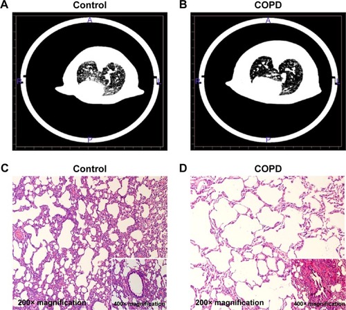 Figure 1 CT analysis and histopathology examination of COPD rats.