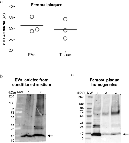 Figure 5. S100A9 expression on human femoral EVs and arterial tissue. (a) S100A9 mRNA was detected by RT-qPCR in EVs from conditioned medium of human femoral atherosclerotic plaques ex vivo (n = 3), and locally in femoral atherosclerotic tissues (n = 3). EVs were pretreated with proteinase K and RNase before RNA isolation to eliminate possible RNA contaminants from non-EVs sources. Data are presented as Ct values. (b, c) Representative western blots for S100A9 in EVs from femoral plaques (panel b, n = 2) and in atherosclerotic femoral tissue (panel c, n = 3). We were able to detect the monomers of S100A9 (≈14 kDa, black arrow), and also found bands at higher sizes (≈24 to 70 kDa) corresponding to the heterodimeric, trimeric or tetrameric forms of S100A9.
