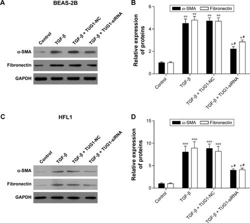 Figure 7 Silencing of TUG1 suppresses the expression levels of α-SMA and fibronectin proteins in BEAS-2B and HFL1 cells. (A) Silencing of TUG1 expression by siRNA inhibited the expression levels of α-SMA and fibronectin proteins, while TGF-β promoted the expression levels of α-SMA and fibronectin proteins. About 50 μM negative control (NC) siRNAs or TUG1 siRNAs (si-TUG1) and 2 ng/mL TGF-β were transfected into BEAS-2B cells for 48 h. The expression levels of α-SMA and fibronectin proteins were detected by Western blot in BEAS-2B cells. (B) Gray statistical analysis of the expression levels of α-SMA and fibronectin proteins in BEAS-2B cells. #P<0.05 as compared with BEAS-2B cells treated with 50 μM NC siRNAs and TGF-β (2 ng/mL); *P<0.05 as compared with BEAS-2B cells. **P<0.01. (C) The expression levels of α-SMA and fibronectin proteins were detected by Western blot in HFL1 cells treated as mentioned earlier. GAPDH was used for internal control. (D) Gray statistical analysis of the expression levels of α-SMA and fibronectin proteins in HFL1 cells. #P<0.05 as compared with HFL1 cells treated with 50 μM NC siRNAs and TGF-β (2 ng/mL); *P<0.05 as compared with HFL1 cells. ***P<0.001.