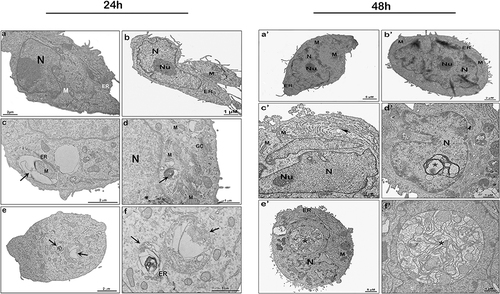 Figure 4 Ultrastructure of MDA-MB-231 cells treated by nano-encapsulated tarin and analyzed through transmission electron microscopy after 24 h (left panel) and 48 h (right panel) of exposition. Control (a, a’), empty liposome (b, b’), and nano-encapsulated tarin at 72 μg/mL (c-f, c’-f’). Autophagosomes are indicated by the black arrows in the left panel; enlarged endoplasmatic reticula, by the black arrow in the right panel; mitochondrial swelling, by the black arrowhead; and cytoplasmic inclusion bodies near the nucleus, by asterisks.